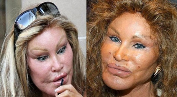Jocelyn Wildenstein